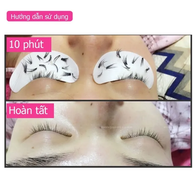 Tháo mi sáp